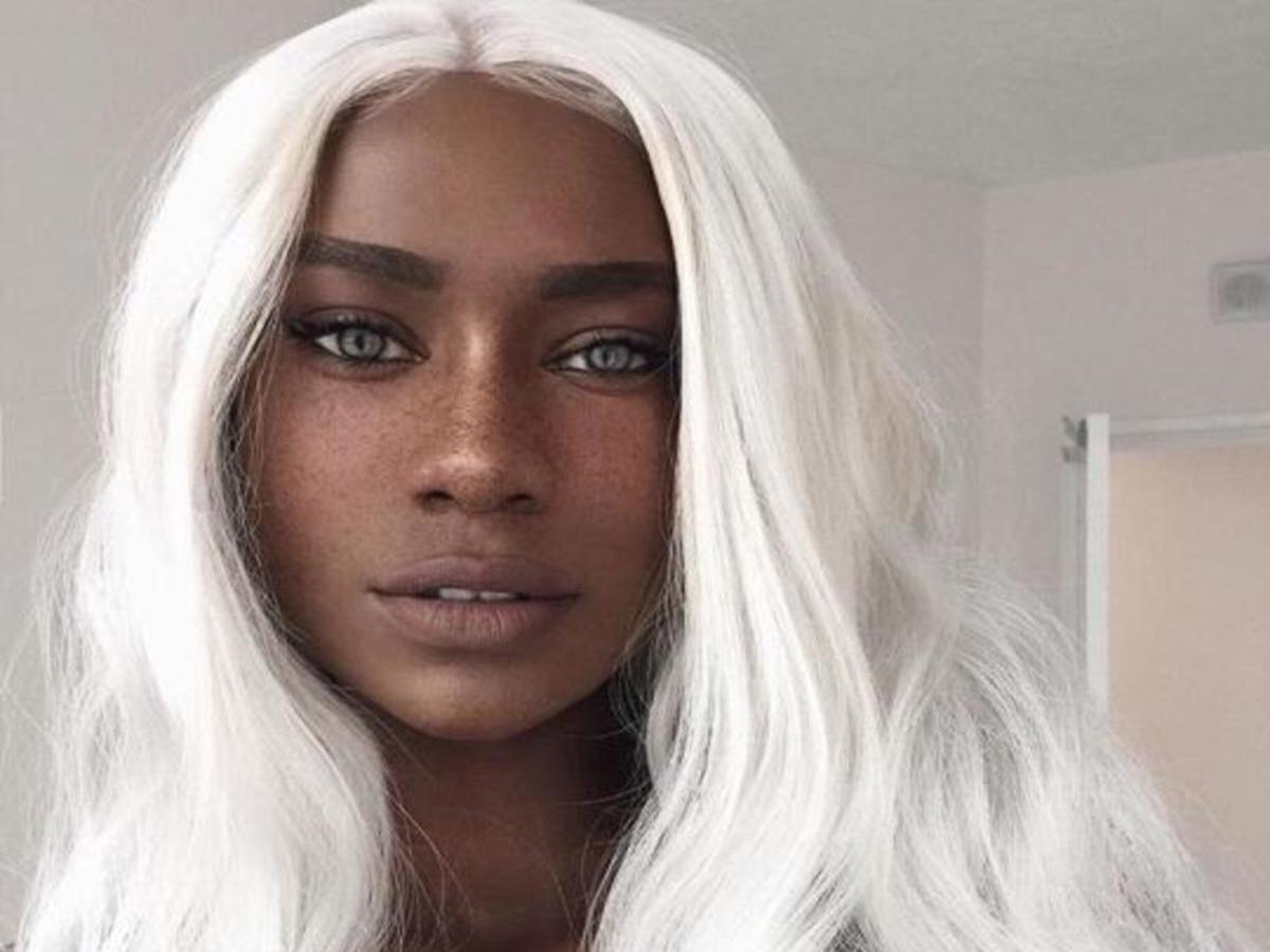 Bee Melvnin, A black woman was born with white hair.  